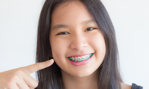 girl with braces pointing at smile