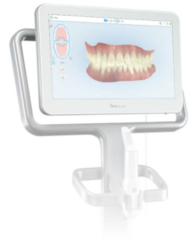 iTero intraoral scanner