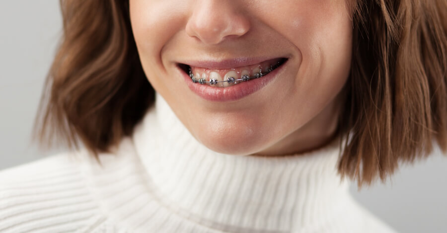 woman with braces smiling