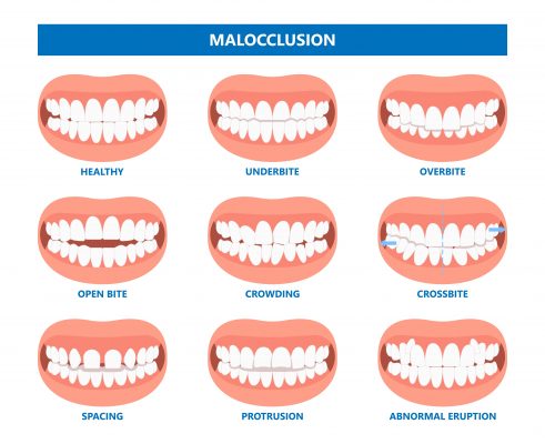 orthodontic issues